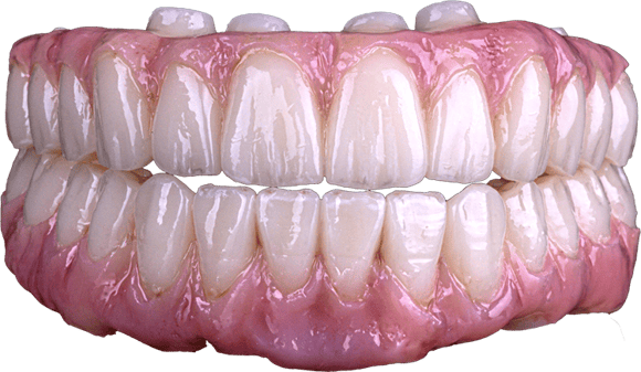 Full arch implant prosthetic