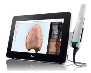 iTero Lumina Pro mobile - NIRI case, side view (1)