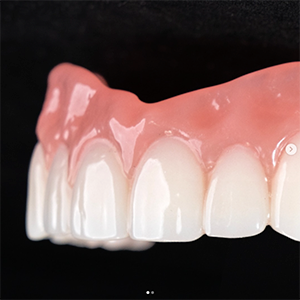 FDLG-Denture