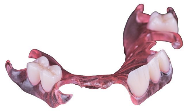 3D flexible partials