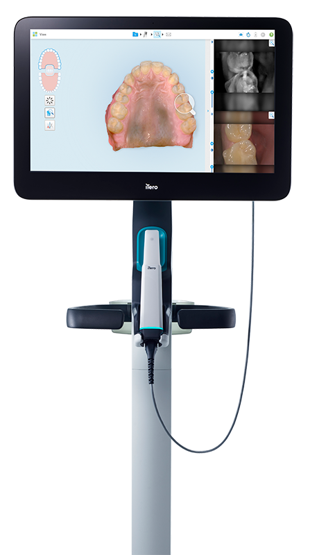 iTero Lumina Pro cart - Single crown with IOC, front view