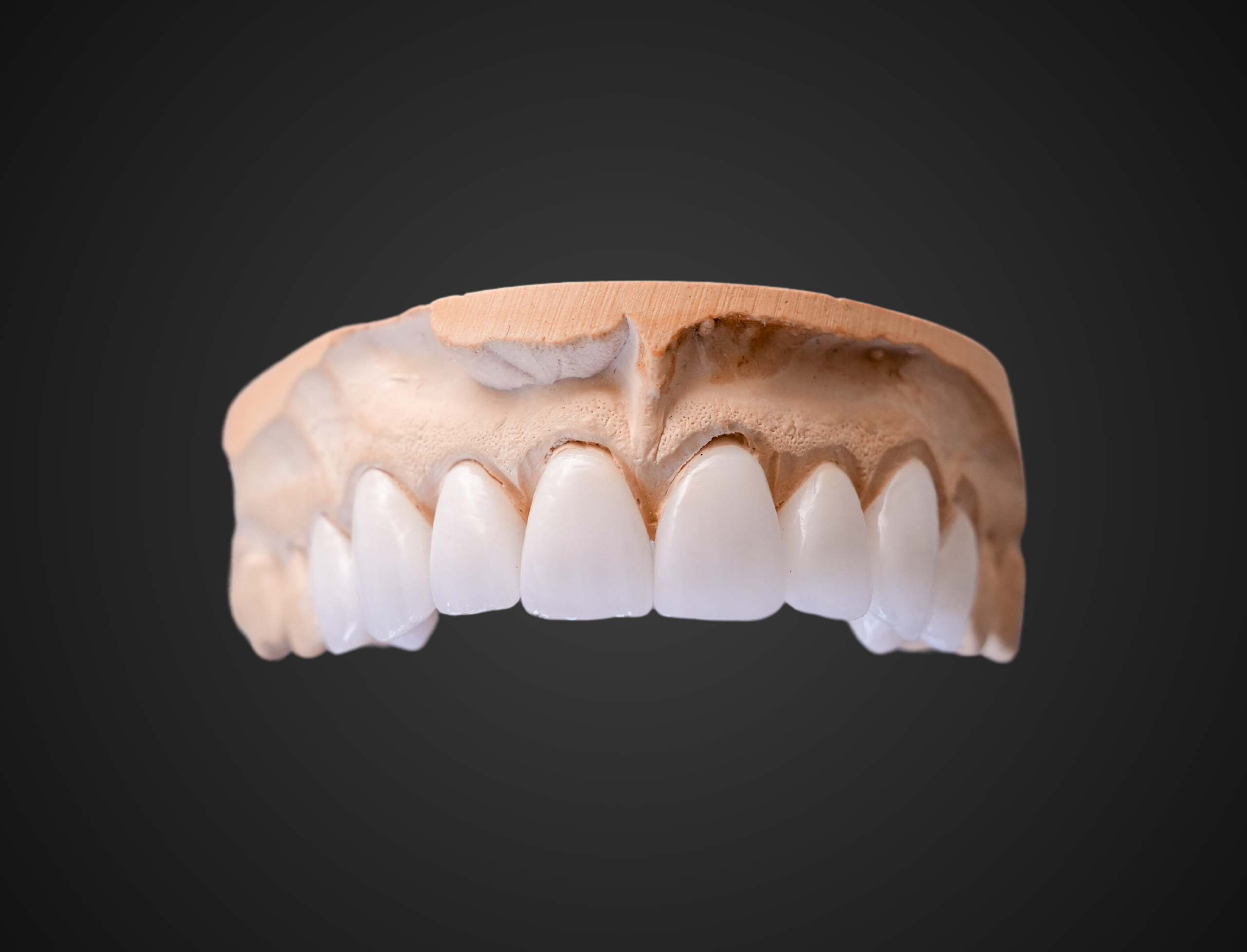 The 5 Crown Prep Standards That Deliver Better Fits and Fewer Adjustments